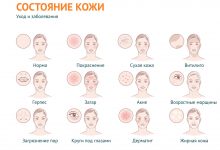 Photo of Причины проблемной кожи и их влияние на состояние дермы